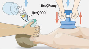 ResQCPR System